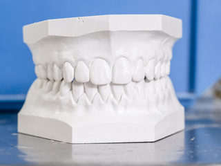 White mold dental of plaster