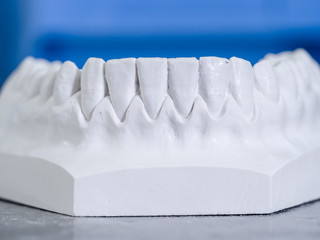 White mold dental of plaster