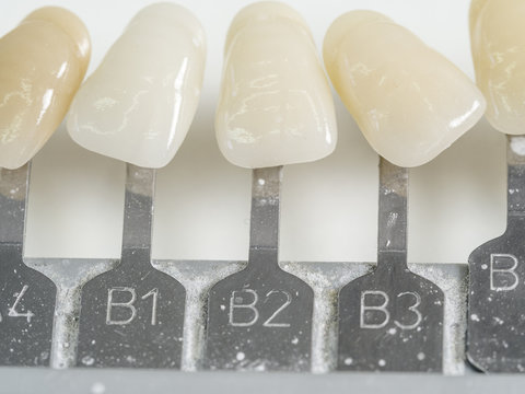 Dental Teeth Samples, Dental Color Shade