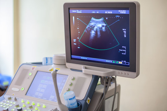 Ultrasound equipment in the clinic.