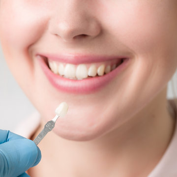 Zahnfarbe wird für einen Zahnersatz einer jungen Frau bestimmt