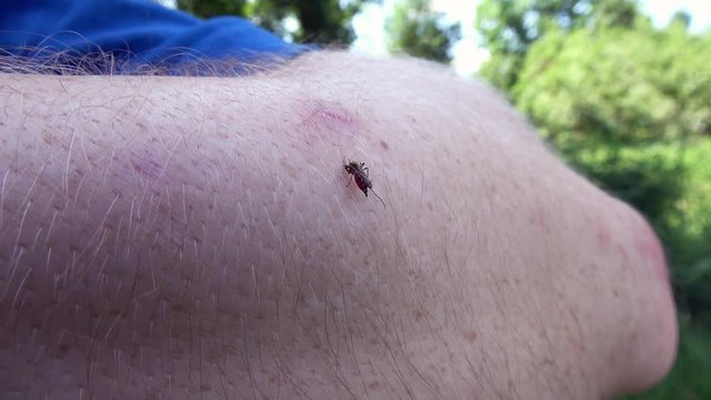 meine M&uuml;cke sitzt auf einem Arm und saugt Blut