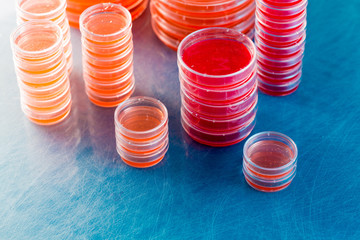 Petri dishes with biological samples  for medical and biological analyzes