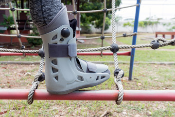 Broken leg the splint for treatment of injured woman on play ground background