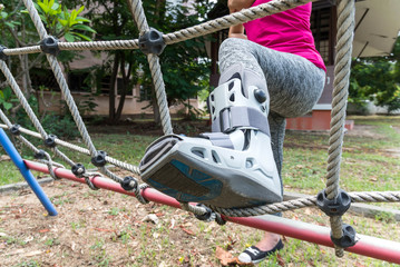 injured woman wearing sportswear  broken ankle wearing ankle support on exercise equipment in a public park background, insurance concept