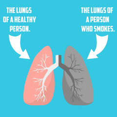 Normal lung and lung cancer illustration