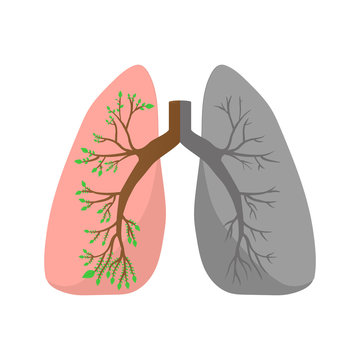 Normal lung and lung cancer illustration