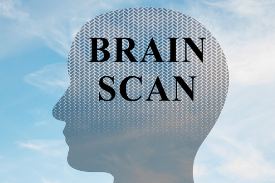 Brain Scan - mental concept