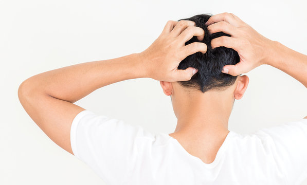 Young Man Suffering From Itching Her Head, Itching Scalp.