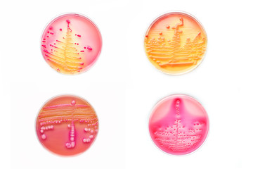 Bacteria colonies in various petri dish
