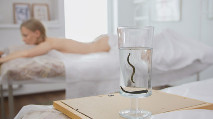 Bank with leeches against the background of a blonde girl - hirudotherapy
