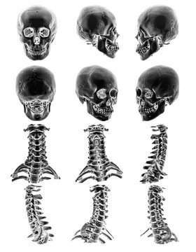 CT scan ( Computed tomography ) with 3D graphic show normal human skull and cervical spine