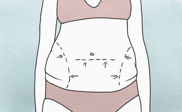 Midsection of woman with marked outlines on abdomen