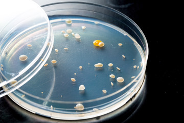 Petri dish with bacterial culture