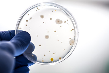 Scientist holding bacteria culture on agar