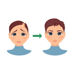 Woman with alopecia before and after hair treatment and transplantation. Female hair loss set.Before and after make over series of a balding lady. Beauty concept design. Isolated vector illustration.