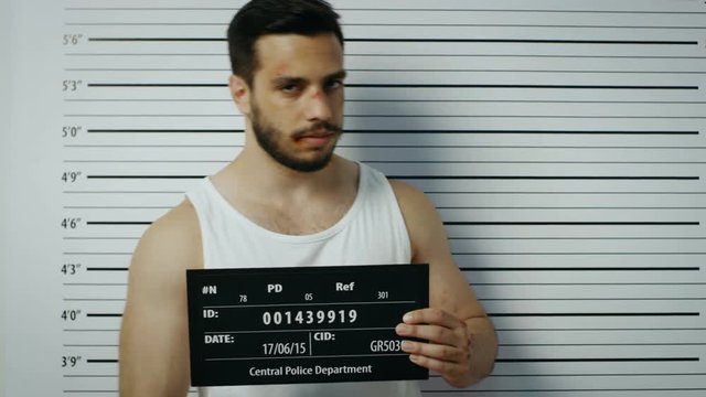 In a Police Station Arrested Beaten Man Poses for Side, Front View Mugshot. He Wears Singlet, is Heavily Bruised and Holds Placard. Height Chart in the Background. 4K UHD.