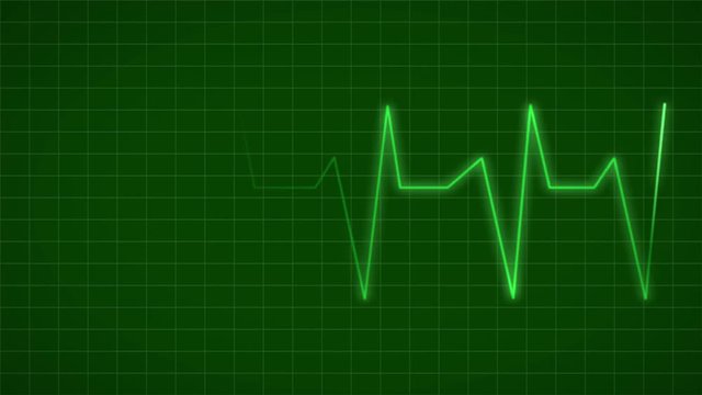 ECG Electrocardiogram Display Heart Rate Beat Pulse Looped animated background.
