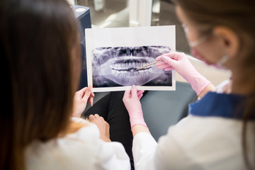 Female young dentist examining x-ray image with female patient in dental clinic and preparing for treatment. Focus on the picture. Dentistry
