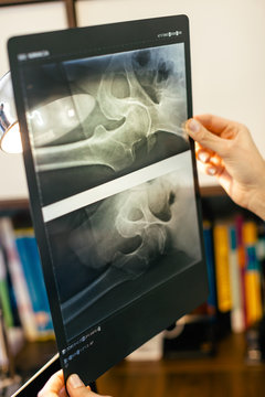 Doctor woman holding a radiography.