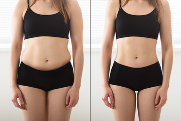 Before And After Diet Concept - obrazy, fototapety, plakaty