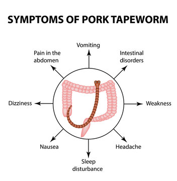 Symptoms of Pork tapeworm. Infographics. Vector illustration on isolated background