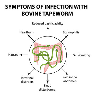 Symptoms of infection are bovine tapeworm. Infographics. Vector illustration on isolated background