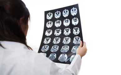 Female Doctor looking at a tomography x-ray picture of Eyes.
