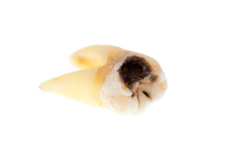 Old torn tooth on a white background