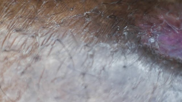 Close up of Human Skin Texture 
