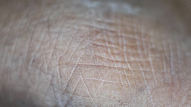 Close up of Human Skin Texture 
