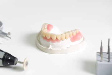 Zahnersatz im Prothesenträger im Dentallabor