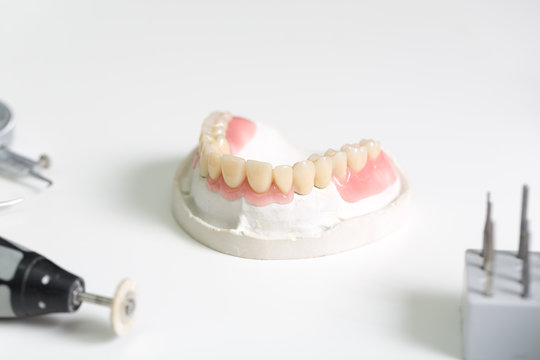 Zahnersatz im Prothesentr&auml;ger im Dentallabor