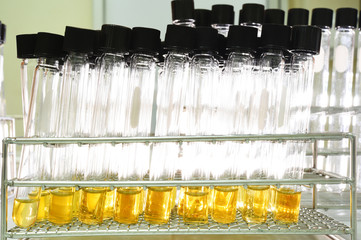 experiment in chemical laboratory with yellow liquid for analysis