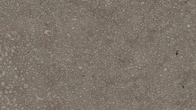 human kidney cells under a microscope zoom in animation
