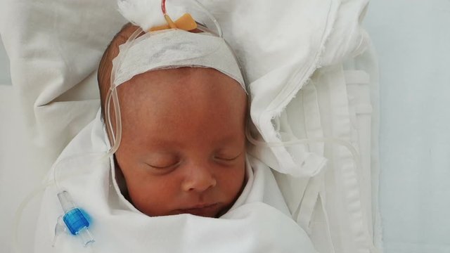 Newborn baby sleeping on a drip in a hospital