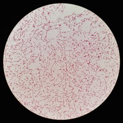Smear of gram negative bacilli bacteria under 100X light microscope (Selective focus).