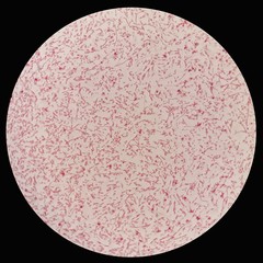 Smear of gram negative bacilli bacteria under 100X light microscope (Selective focus).