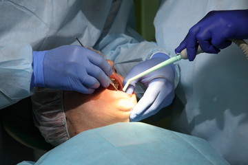 Dentist treating a patient's teeth with dental tools in dental clinic. Dentistry.