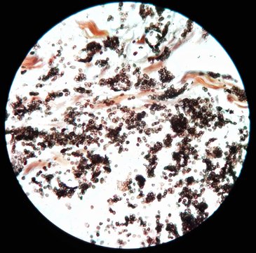 Smear from tissue biopsy Giemsa stained under 100X light microscope with positive Penicillium marneffei, a dimorphic fungus which is a pathogen cause "Penicilliosis" and endemic in Southeast Asia.