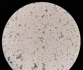 Stool examination under 40X light microscopy.