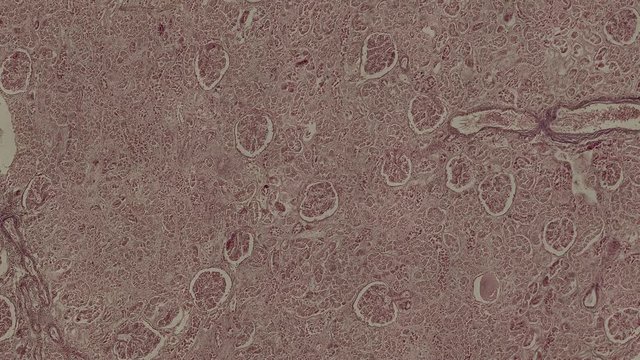 human kidney cells under a microscope zoom in animation