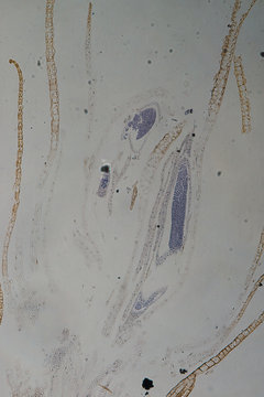 Moss reproductive parts Polytrichum Antheridia