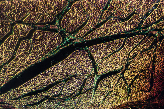 striated muscle