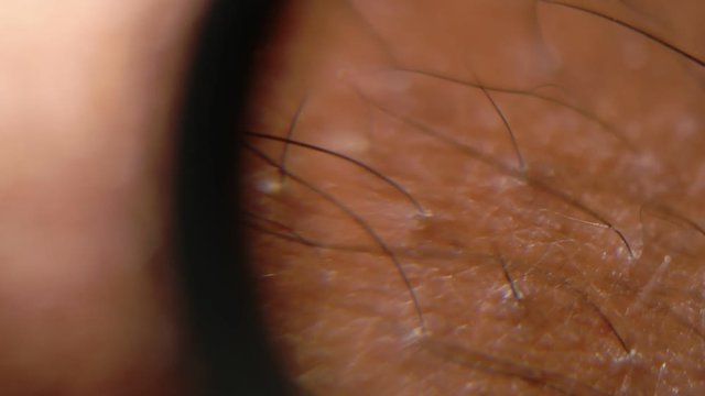 Close up of Human Skin Texture 
