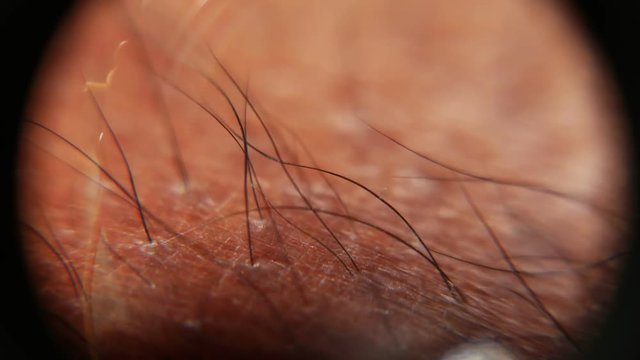 Close up of Human Skin Texture 
