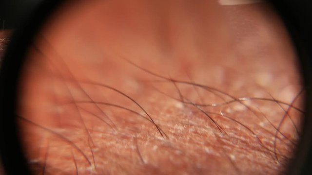 Close up of Human Skin Texture 
