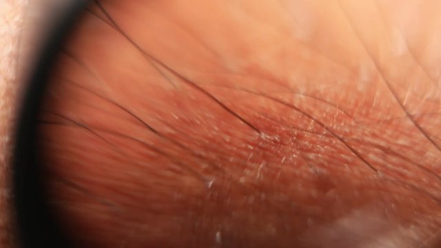 Close up of Human Skin Texture 
