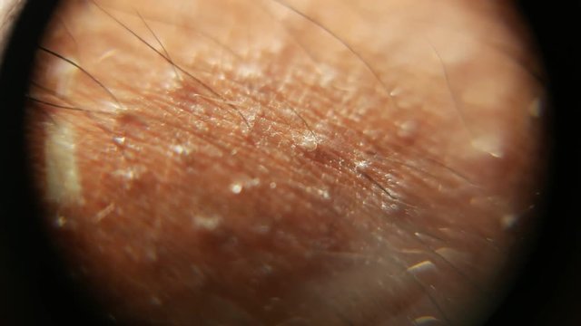 Close up of Human Skin Texture 

