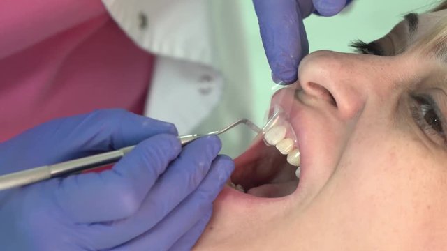 Dentist puts dental veneers patient